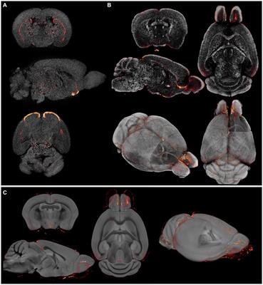 An MR-based brain template and atlas for optical projection tomography and light sheet fluorescence microscopy in neuroscience